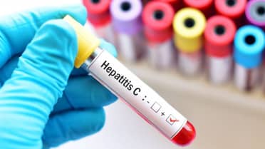 La lucha contra la hepatitis C: por qué es un caso de éxito ejemplar