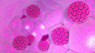 El virus del papiloma humano y su vacuna