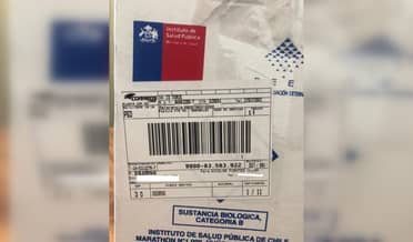 Cyberday: Compró zapatillas por Internet y recibió una caja con muestras de sangre del ISP