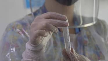 Minsal confirma presencia de "bacteria asesina" en varios casos de influenza