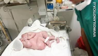 Diagnóstico lapidario: siamesas no sobrevivirán al largo plazo