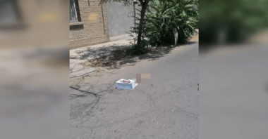 Encuentran un brazo amputado en plena vía pública
