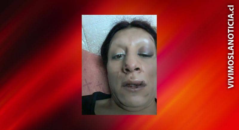 Repudian ataque a transexual talquina