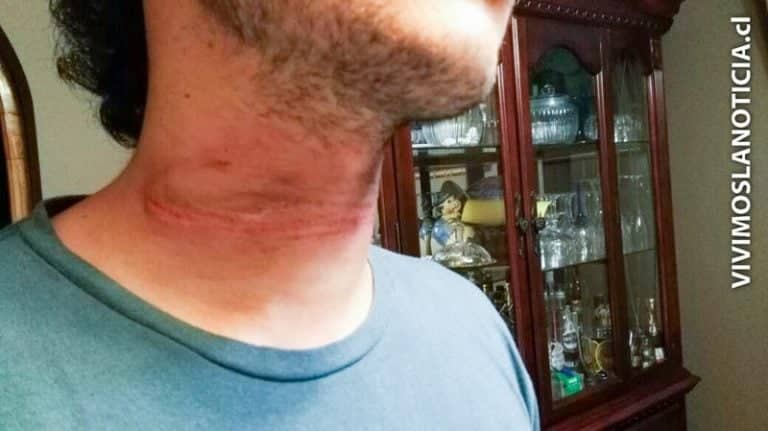 TRAMPA MORTAL: Universitario a punto a morir ahorcado