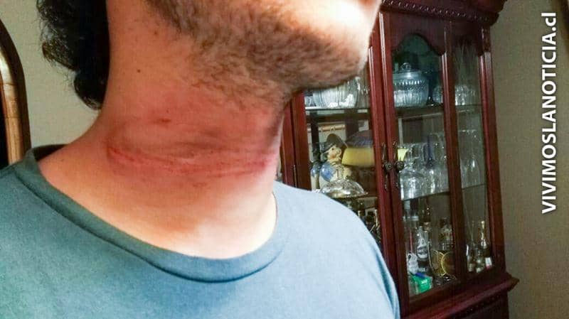 TRAMPA MORTAL: Universitario a punto a morir ahorcado