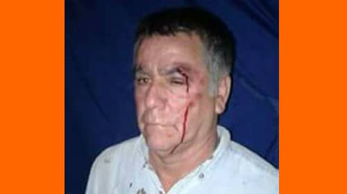 Reo denuncia agresión dentro de cárcel de Curicó