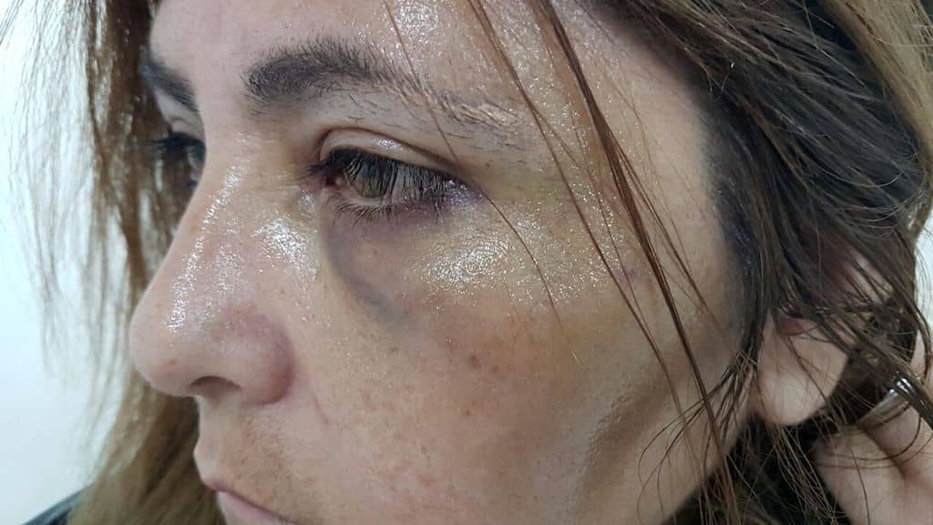 Dueña de casa fue brutalmente abusada por drogadicto