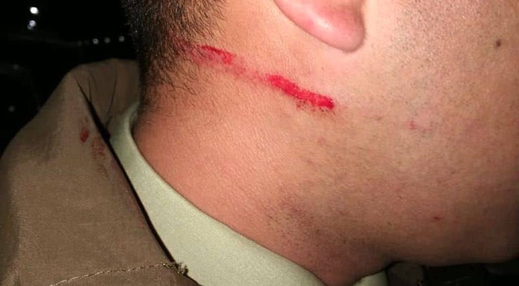 En prisión preventiva sujeto que agredió a carabinero