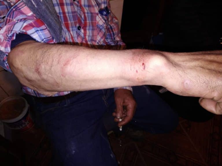 Denuncian a 3 carabineros de Licantén por presunta agresión y abuso de poder