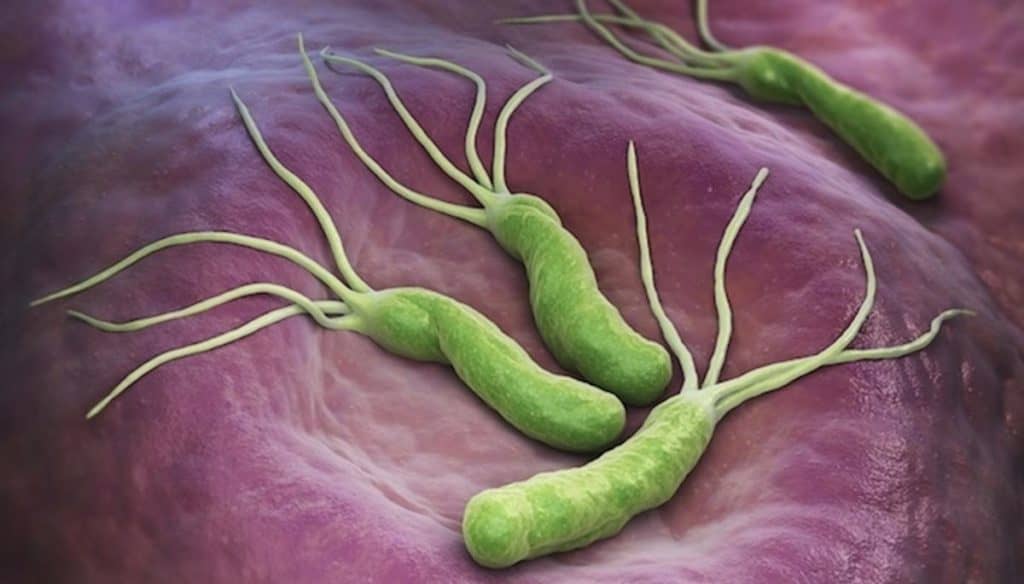Gastroenterólogos advierten que un 70% de la población chilena porta la bacteria helicobacter pylori