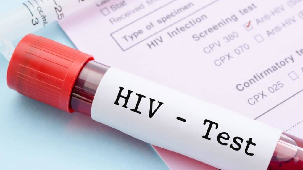 Este miércoles se realizará en Curicó una masiva toma de test rápidos de VIH