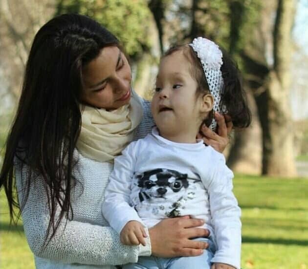 Falleció niña de 5 años de Curicó que padecía de hidrocefalia extrema