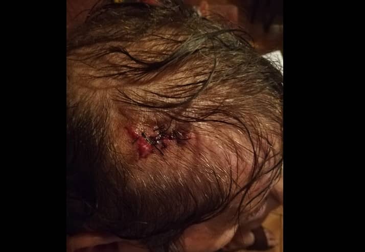 Adulto mayor de 74 años fue asaltado y golpeado por un desconocido en Curicó