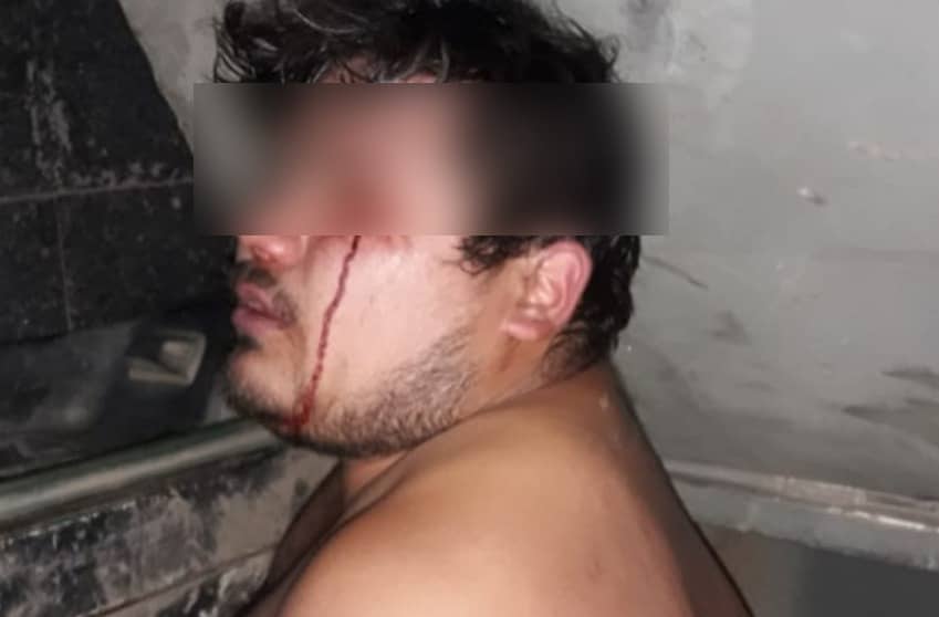 Tres jóvenes acusaron a Carabineros de Llico de agredirlos al ser detenidos