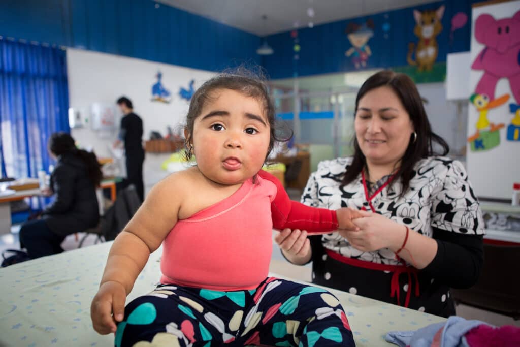 Coaniquem del Maule hace llamado a las autoridades a crear subvención para protección de niños quemados