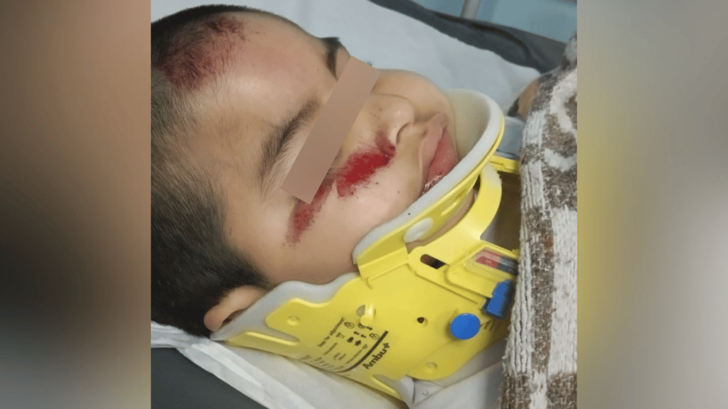Familia pide ayuda para recuperación de niño de 5 años lesionado en accidente de tránsito