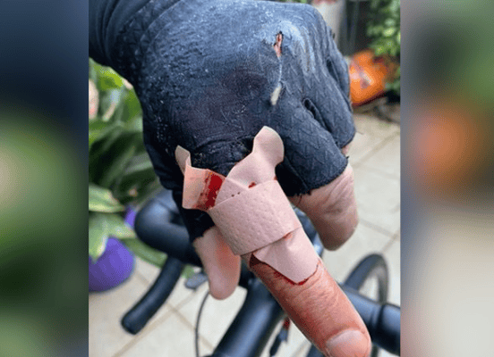 Ciclista sufrió cortes por hilo curado usado para elevar volantines en Avenida Curicó