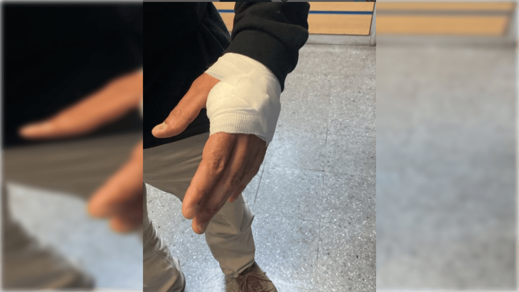 Seguridad Municipal de Curicó califica como un intento de homicidio ataque a inspector en procedimiento