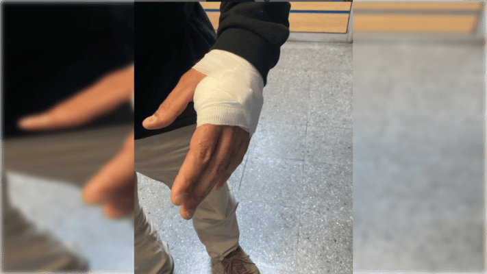 Seguridad Municipal de Curicó califica como un intento de homicidio ataque a inspector en procedimiento