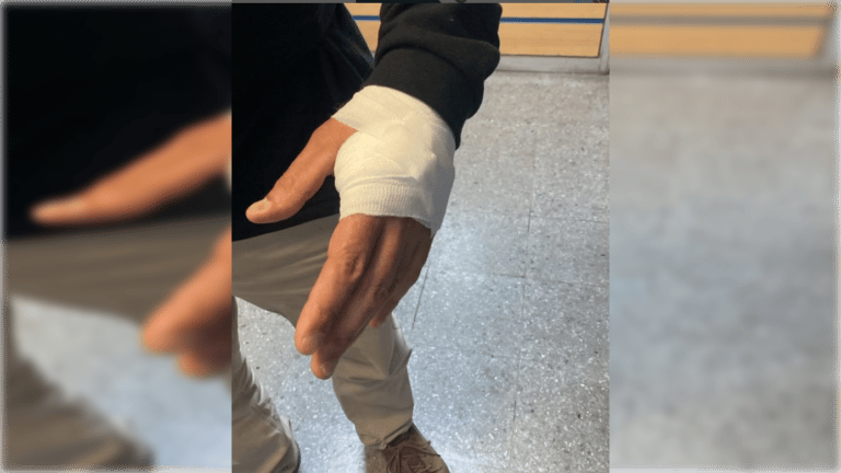 Seguridad Municipal de Curicó califica como un intento de homicidio ataque a inspector en procedimiento