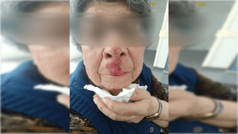 Caída de locataria al interior de la Felicur provoca conflicto con la administración del recinto