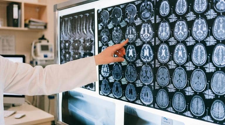 Identificar un ACV a tiempo: la importancia del método FAST