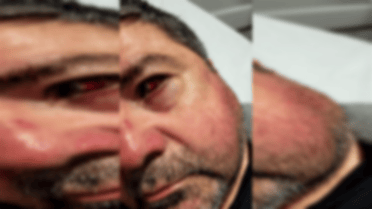 Expresidente del Mercado Municipal de Curicó fue brutalmente agredido: Familia presentará querella por homicidio frustrado