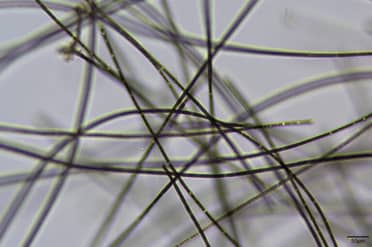 Riesgo Máximo: Lago Vichuquén supera umbral de Alerta 2 de la OMS por toxinas de cianobacterias