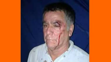 Reo denuncia agresión dentro de cárcel de Curicó