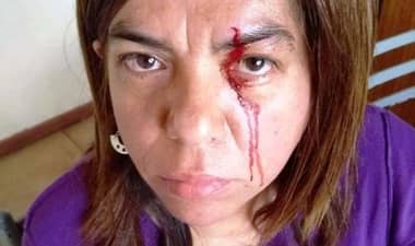 Oficial civil brutalmente atacada por ex marido en Licantén