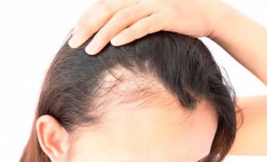Nutricionista indicó los 14 alimentos que ayudan a evitar la caída del cabello