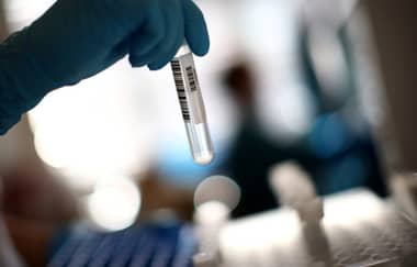 Casos COVID-19 aumentan 30% en una semana
