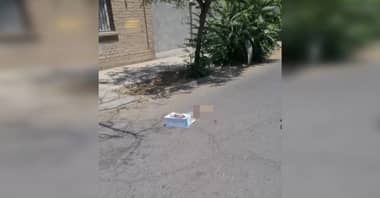 Encuentran un brazo amputado en plena vía pública