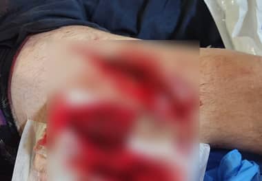 Macabro hecho de sangre en Rauco: ataque con arma blanca deja tres heridos en evento de domaduras