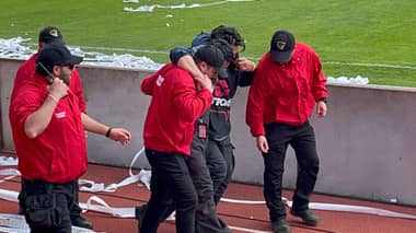 Camarógrafo de TNT Sports sufrió quemaduras en la previa del duelo entre Curicó Unido y Ñublense