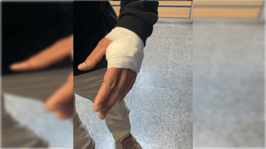 Seguridad Municipal de Curicó califica como un intento de homicidio ataque a inspector en procedimiento