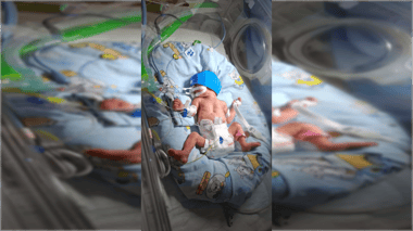 Familia de Molina busca ayuda para visitar a hija prematura de 6 meses en Hospital de Rancagua
