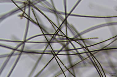 Riesgo Máximo: Lago Vichuquén supera umbral de Alerta 2 de la OMS por toxinas de cianobacterias