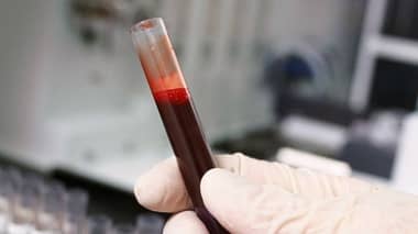 El nuevo examen de sangre que revela problemas cardíacos hereditarios "ocultos"