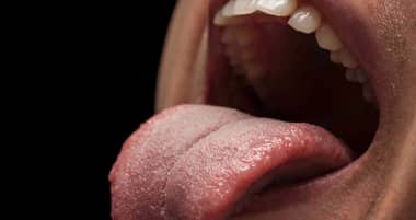 Departamento de Salud de Curicó recomienda medidas de prevención del cáncer oral