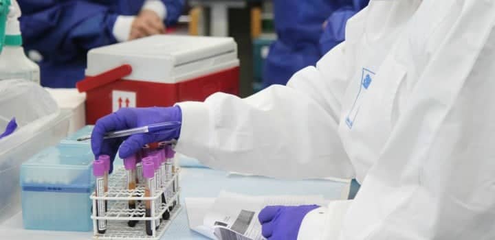 Departamento de Salud de Curicó adoptó cambio de protocolo para aplicar test por Covid-19