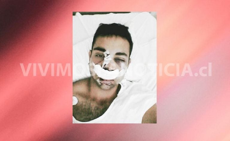 Joven curicano podría quedar paralítico por culpa de conductor ebrio
