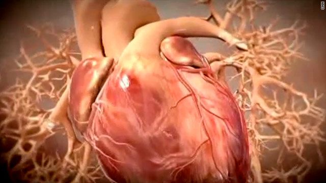 Casi la mitad de los infartos son 'silenciosos'