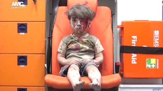 Omran, el niño rescatado de un bombardeo en Siria cuya imagen conmueve al mundo