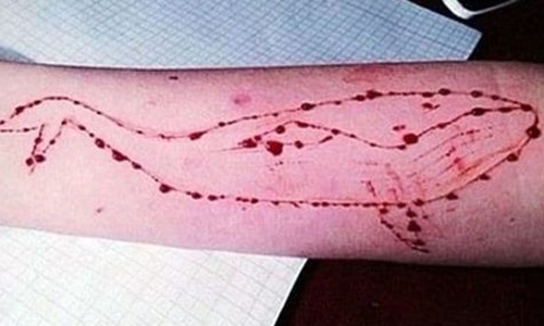 ¿Cómo prevenir ser víctima del juego de la ballena azul?