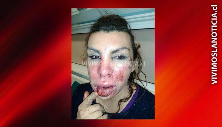 Mujer transgénero sufrió brutal golpiza en pleno centro de Talca