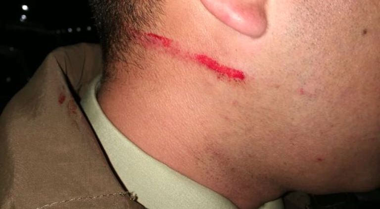 En prisión preventiva sujeto que agredió a carabinero