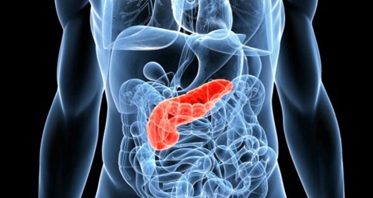 Tabaquismo y diabetes inciden en las cifras de cáncer de páncreas
