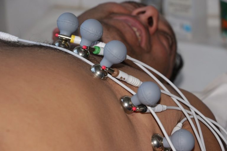Romeral recibió electrocardiograma móvil para postas rurales