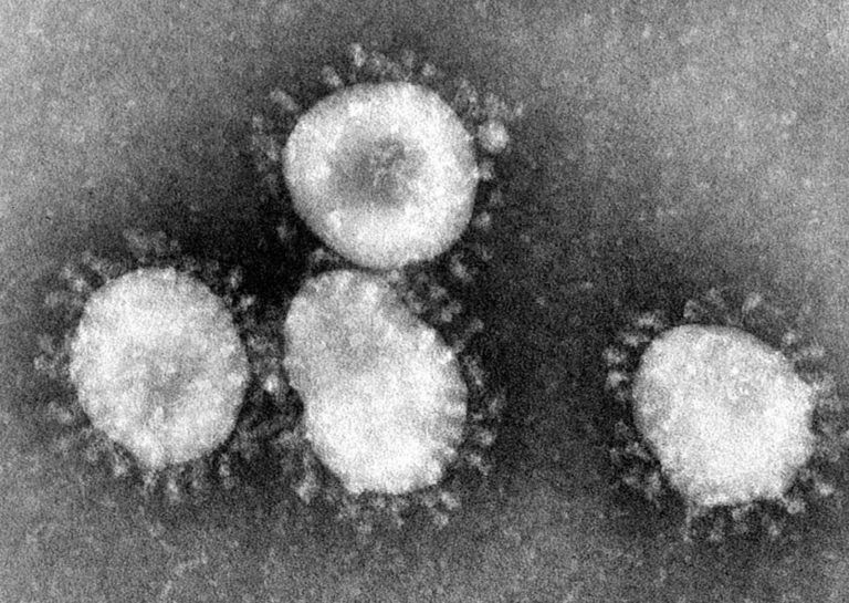 Académico de la Universidad de Talca explica qué es el coronavirus y por qué es tan mortal